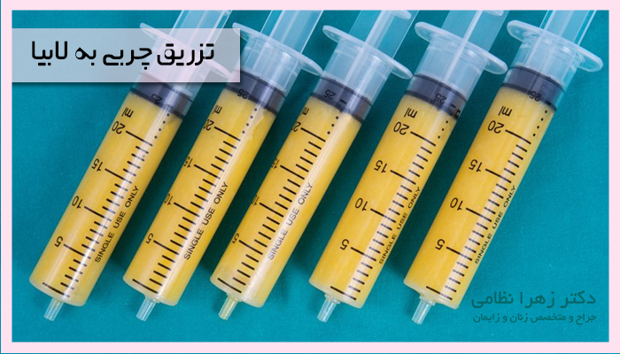 تزریق چربی به لابیا