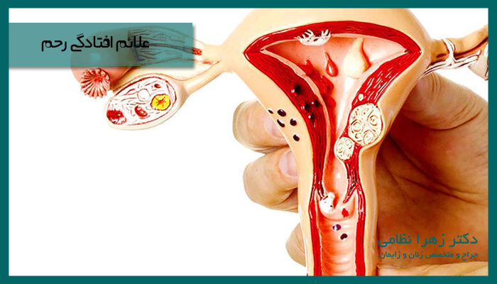 علائم افتادگی رحم