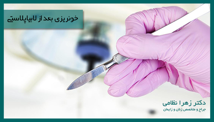 خونریزی بعد از لابیاپلاستی