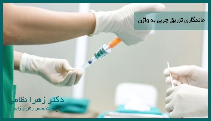 ماندگاری تزریق چربی به واژن