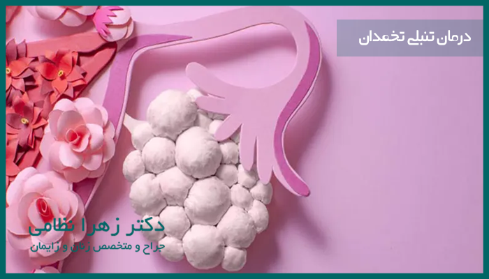 درمان تنبلی تخمدان