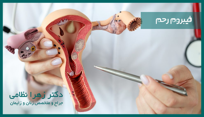 درمان فیبروم در هنگام بارداری