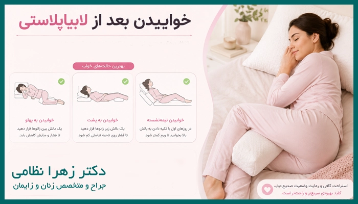 خوابیدن بعد از لابیاپلاستی باید چگونه باشد؟