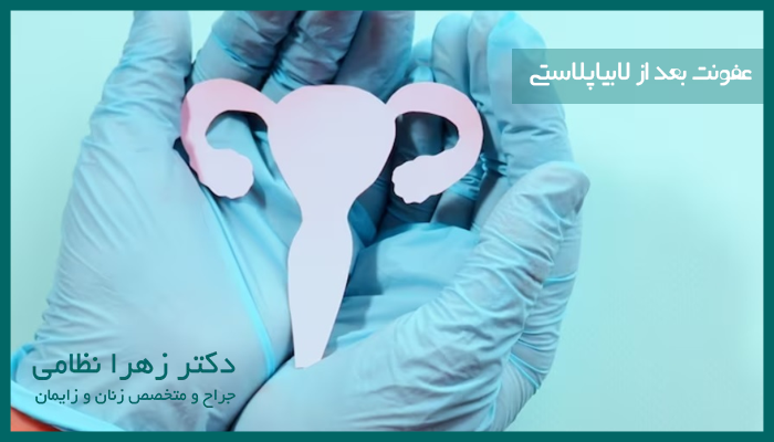 عفونت بعد از لابیاپلاستی چه علائمی دارد؟