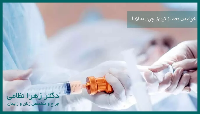 بعد از تزریق چربی به لایبا چطور بخوابیم ؟