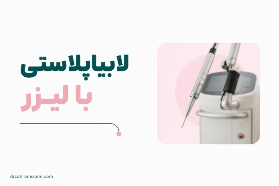 نمای توضیحی درباره انجام لابیاپلاستی با لیزر